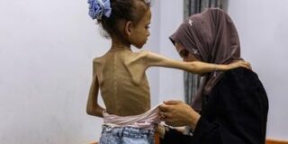 Pessimistic Peace: Weaponising Starvation and the World’s Conscience