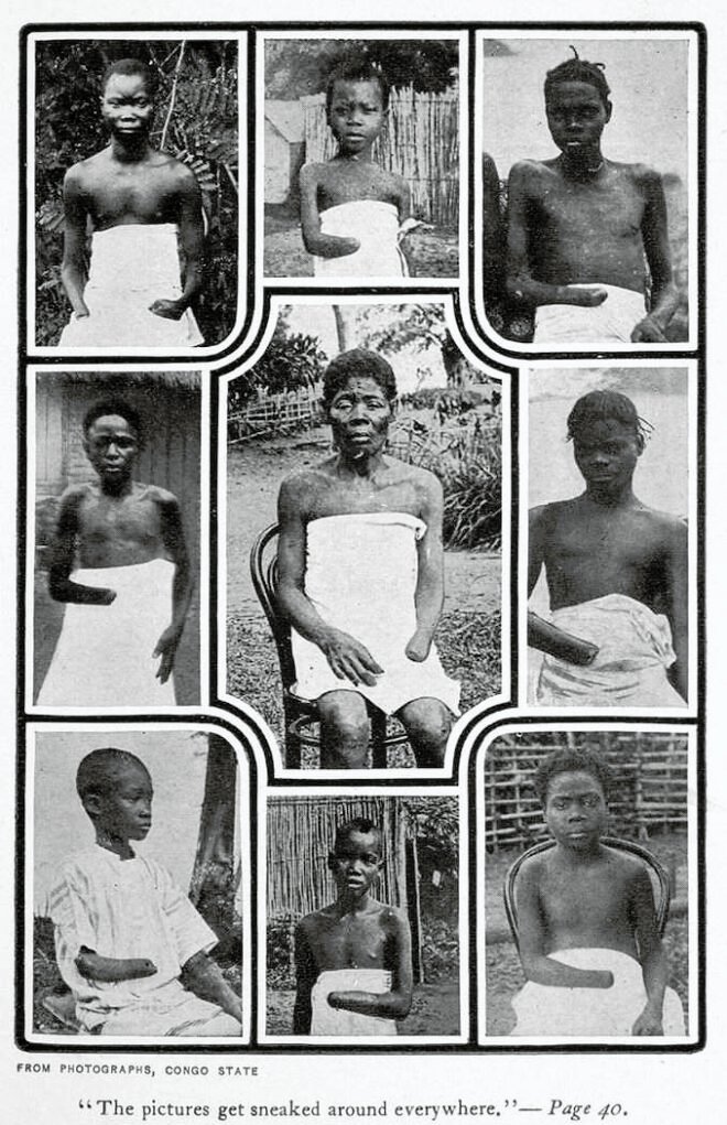 Photographs taken by Alice Seeley Harris of victims of King Leopold's rule of the Congo.
